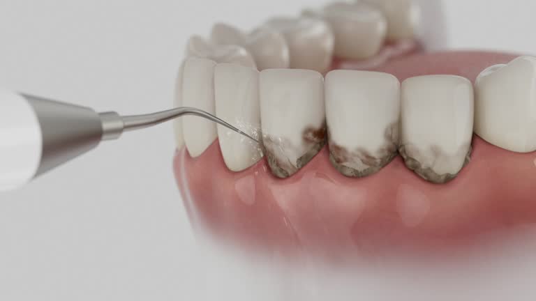 Reliable Dental Implants contractor in Ridgeland, SC by Smile Center Dentistry